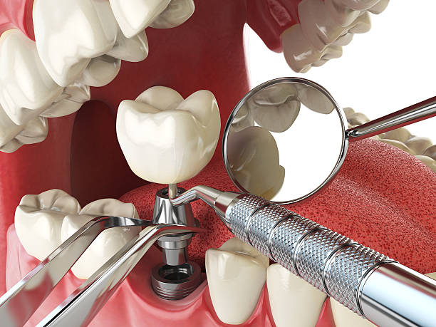 Best Emergency Tooth Extraction in Blairsville, PA